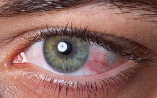 Sausų akių sindromo profilaktika ir gydymas nešiojantiems kontaktinius lęšius